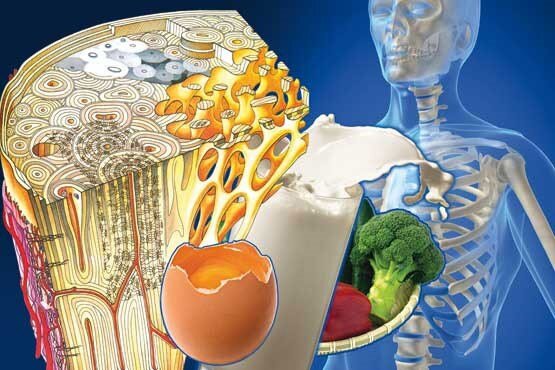 پوکی استخوان؛ تقاطع سلامت استخوان با مزاج، تغذیه و عملکرد معده