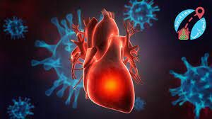 بیماران مبتلا به کرونا علائم "درد و سنگینی قفسه سینه" را جدی بگیرند