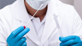 مراکز تست "کرونا" همچنان فعال است/ انجام روزانه 60 تست در کرمانشاه