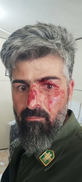 ضرب و شتم محیطبان کرمانشاهی توسط شکارچیان غیرمجاز