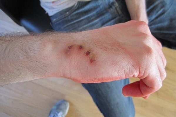 تصویر تزیینی است ثبت ۸۳۵ مورد حیوانگزیدگی در ۳ ماه نخست سال در بندرعباس