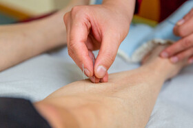 طب سوزنی دانش پزشکی چینی با قدمت چند هزار ساله است