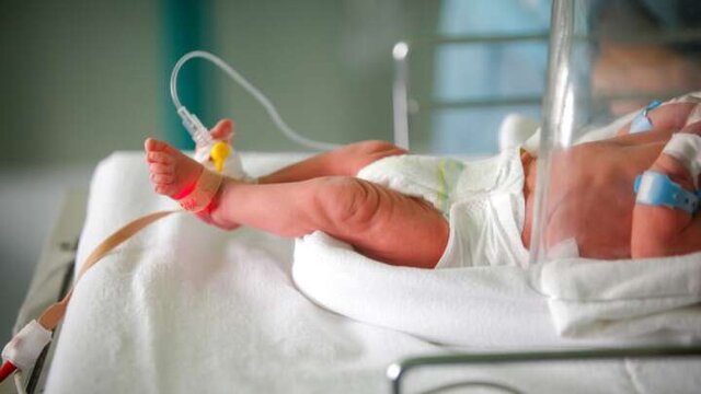 چگونه درد نوزادان نارس را کاهش دهیم؟
