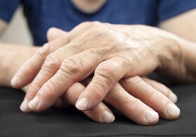 چرا بیماران مبتلا به آرتریت به دررفتگی مفصل در مفاصل درگیر دچار می‌شوند؟