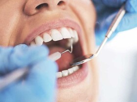 ارائه خدمات دندانپزشکی با تعرفه دولتی در مراکز خدمات جامع سلامت لرستان