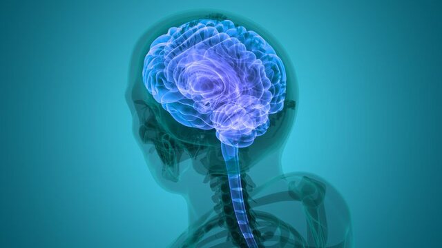 انواع مختلف آلزایمر شناسایی شد