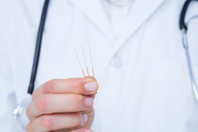 طب سوزنی خطر سکته مغزی را کاهش میدهد؟ طب سوزنی خطر سکته مغزی را کاهش میدهد؟