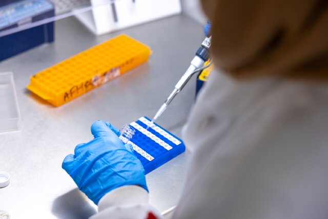 تشخیص بیماریهای پیچیده با کمک «اثر انگشت ایمنی»