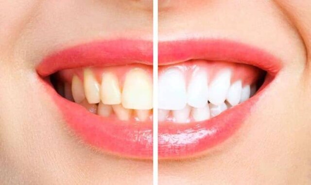 نوشیدنی‌ای که جرم دندان را از بین می‌برد