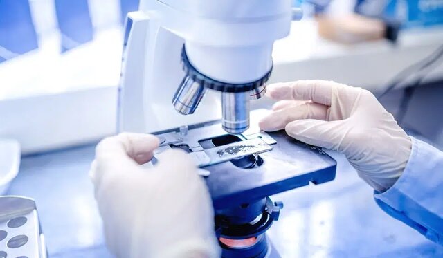 تمیزکاری مغز راهی برای مقابله با پارکینسون و آلزایمر