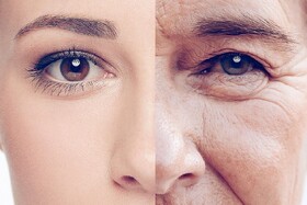 کدام ویتامین بر پوست افراد مسن تاثیر بیشتری دارد؟