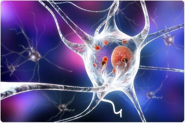 ورزش؛ کلید بهبودی بیماری پارکینسون
