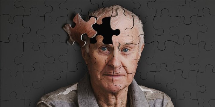 بیماری چشمی، هشدار اولیه ابتلا به آلزایمر است؟