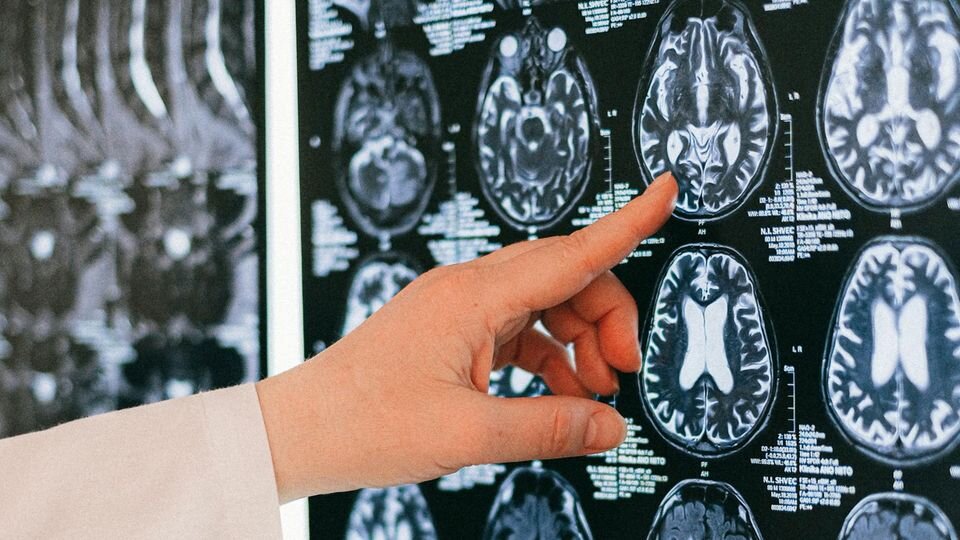 دانشمندان بهترین رژیم غذایی برای حفظ سلامت مغز را معرفی کردند