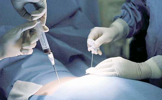 انجام اولین پیوند مغز استخوان کودکان به روش نیمه‌سازگار در خوزستان