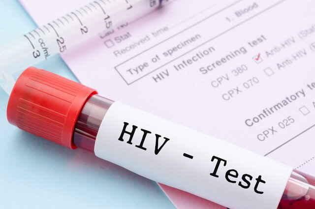اجرای پویش «من هم تست HIV میدهم» در خوزستان اجرای پویش «من هم تست HIV میدهم» در خوزستان