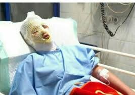 چهارشنبه سوری در کردستان ۳۴ نفر مصدوم  داشت

