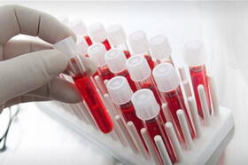 رشد ۶۵ درصدی متقاضیان کردستانی در ذخیره سازی سلول های بنیادی خون بندناف 