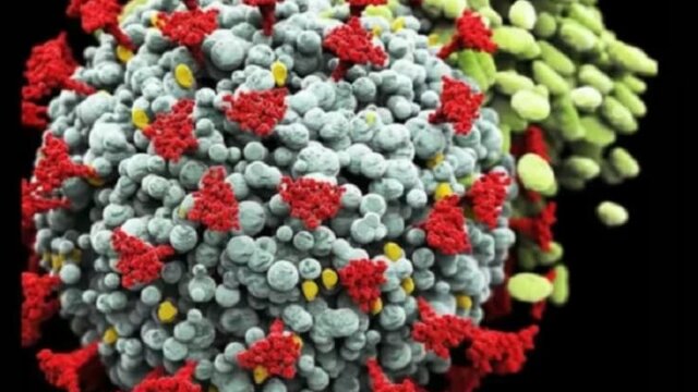 شناسایی 9 بیمار جدید مبتلا به کرونا در کردستان شناسایی 9 بیمار جدید مبتلا به کرونا در کردستان