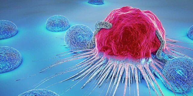 فعالیت فیزیکی و رژیم غذایی؛ عوامل موثر در پیشگیری از سرطان