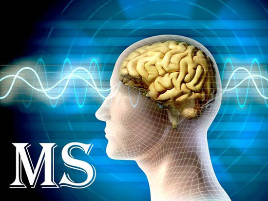 ارائه خدمات درمانی به بیش از ۲۰۰۰ بیمار مبتلا به بیماری M.S در استان کردستان