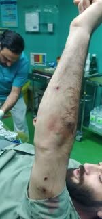 یک قرقاول فاصله بین مرگ و زندگی یک محیطبان