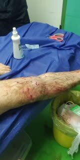 یک قرقاول فاصله بین مرگ و زندگی یک محیطبان