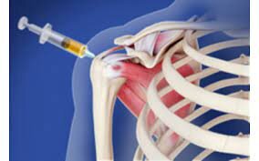 ضرورت راه اندازی سلول درمانی صنعتی در کشور