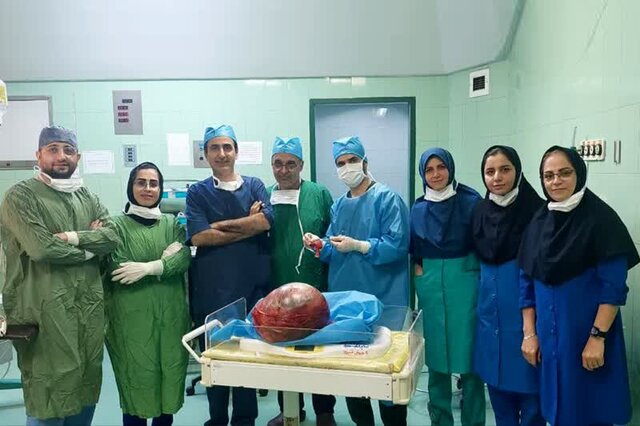 خارج کردن توده ۶ کیلوگرمی از شکم بیمار آملی در بیمارستان روحانی بابل