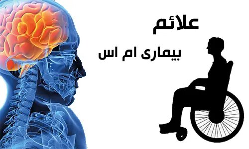 رنج مضاعف بیماران «ام اس» آمل برای تامین دارو