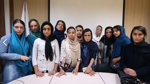 پرداخت ۱.۴ میلیارد تومان به ۲۴ نفر از دانش آموزان حادثه دیده شین آبادی پرداخت ۱.۴ میلیارد تومان به ۲۴ نفر از دانش آموزان حادثه دیده شین آبادی