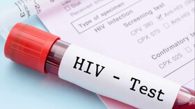 ویروس HIV از جفت عبور نمی‌کند