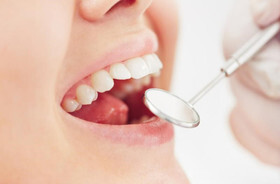نوع خمیر دندان برای رفع جرم و زردی تاثیرگذار  نیست