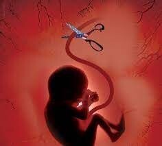 علل شایع سقط جنین در مادران باردار