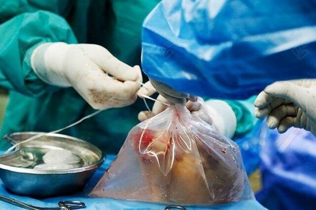 عکس تزئینی است اهدای عضو جوان زنجانی جان چهار بیمار را نجات داد