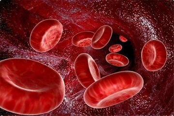 غلظت خون چیست و چه علائمی دارد؟ 