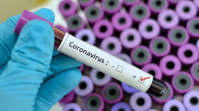 آزمایش تشخیصی ویروس کرونا از فردا در تبریز انجام می‌شود