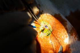 چشمهای "سیلیش" و "تیتو" عمل شدند