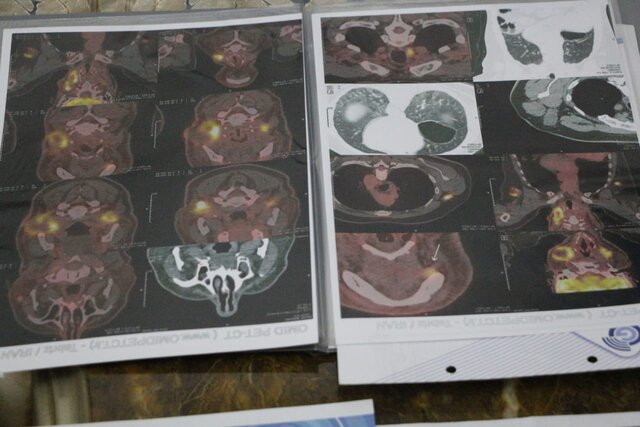 پای گلایههای یک جانباز