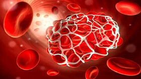  بیماران هموفیلی، همچنان منتظر باشند/ کمبودهای دارویی سراسری است 