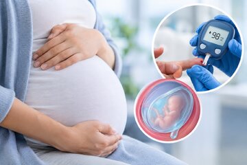 آیا دیابت، خطر پارگی زودرس کیسه آب را بیشتر می‌کند؟