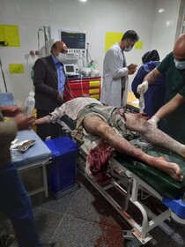 حمله پلنگ به مرد ۳۶ ساله در بخش پاتاوه