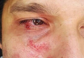 برخورد قانونی و جدی با فرد ضارب پزشک گچسارانی