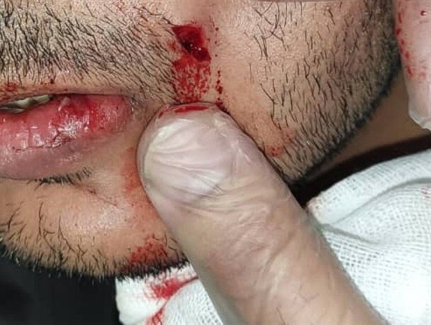 ماجرای ضرب و شتم یک پزشک بیمارستان بی بی حکیمه(س) گچساران