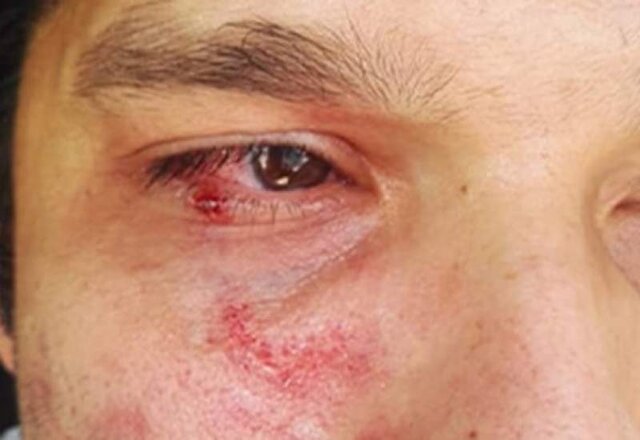 ماجرای ضرب و شتم یک پزشک بیمارستان بی بی حکیمه(س) گچساران