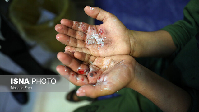 عکس: آرشیو انفجار مواد محترقه دستساز در قزوین حادثه آفرید