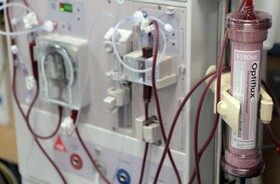 خریداری ۱۵ دستگاه دیالیز جدید برای بیمارستان‌های زنجان