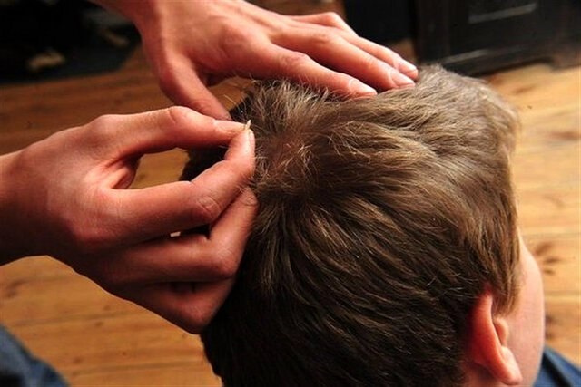 عکس تزئینی است انباشته شدن لباسها در مدارس، از عوامل اصلی شیوع شپش است