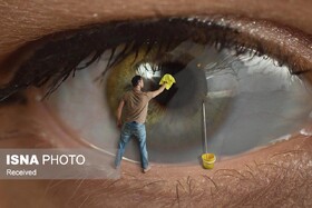 جراحی، آب مروارید را به طور قطع درمان می‌کند