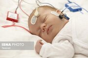 غربالگری شنوایی نزدیک به ۵ هزار نوزاد زنجانی در نیمه نخست امسال